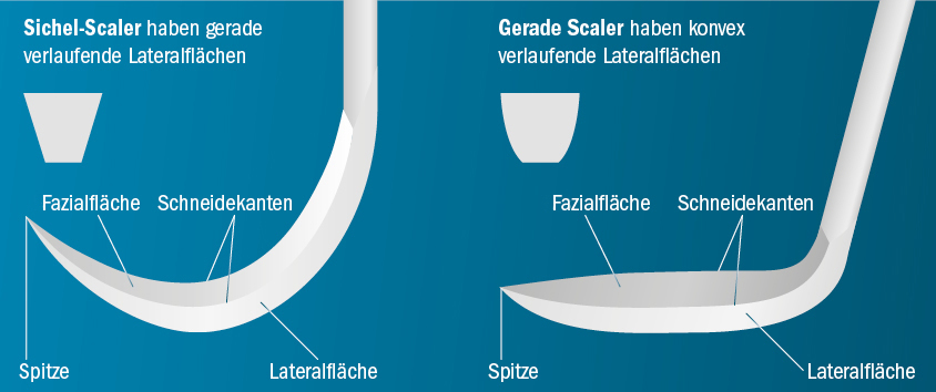 Geomaterische Unterscheidung eines Sichelscalers und einem geraden Scaler